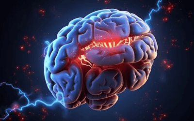 How is Deep Brain Simulation used for Epilepsy?